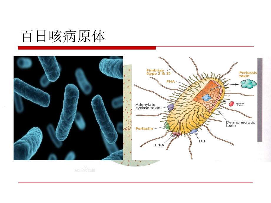 百日咳综合征演示教学_第4页