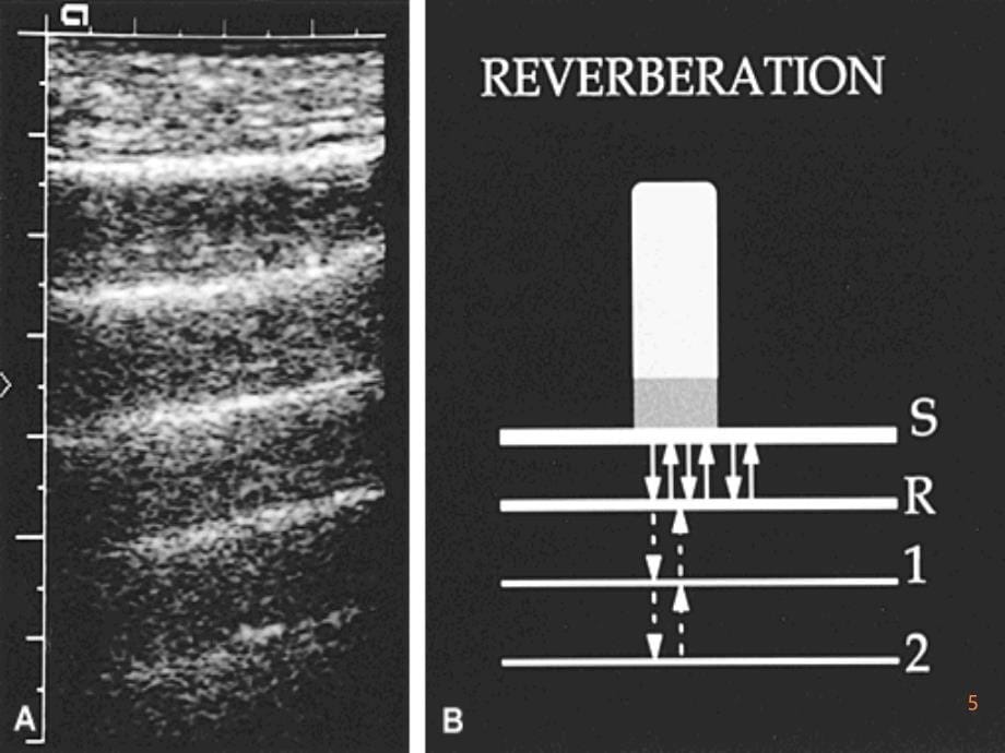 肝胆疾病超声诊断PPT课件_第5页