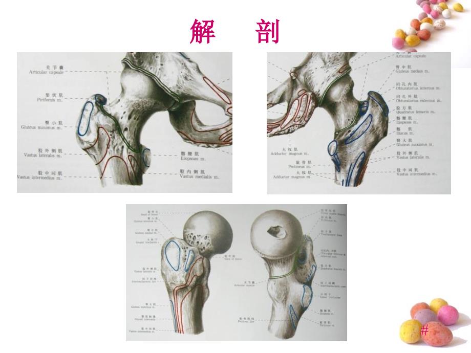 转子间骨折内固定选择策略ppt课件_第4页