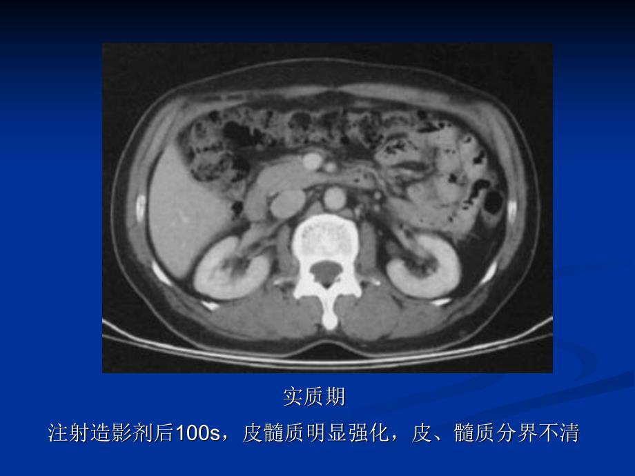 泌尿系统及中枢神经系统室验片教学材料_第4页