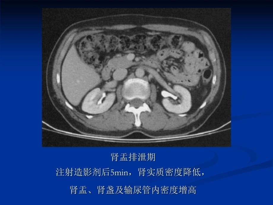 泌尿系统及中枢神经系统室验片教学材料_第5页