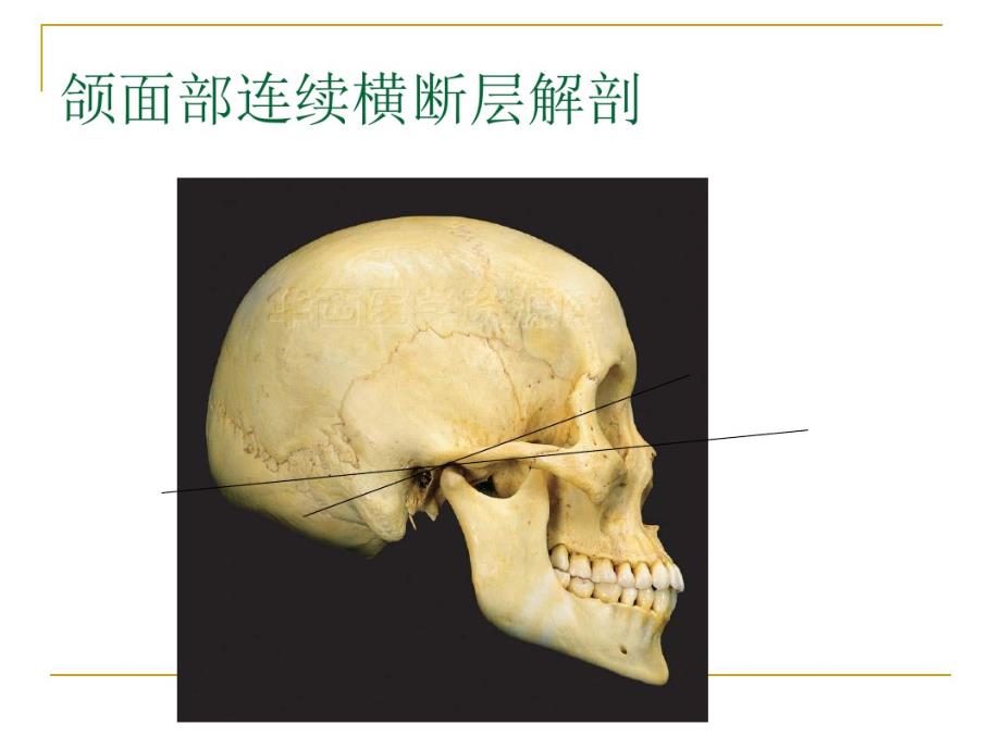 最新03颌面部连续横断层解剖与CT、MRI(11研究生)_第1页