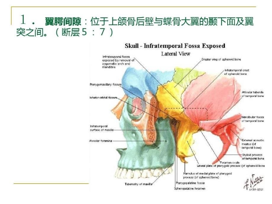 最新03颌面部连续横断层解剖与CT、MRI(11研究生)_第5页