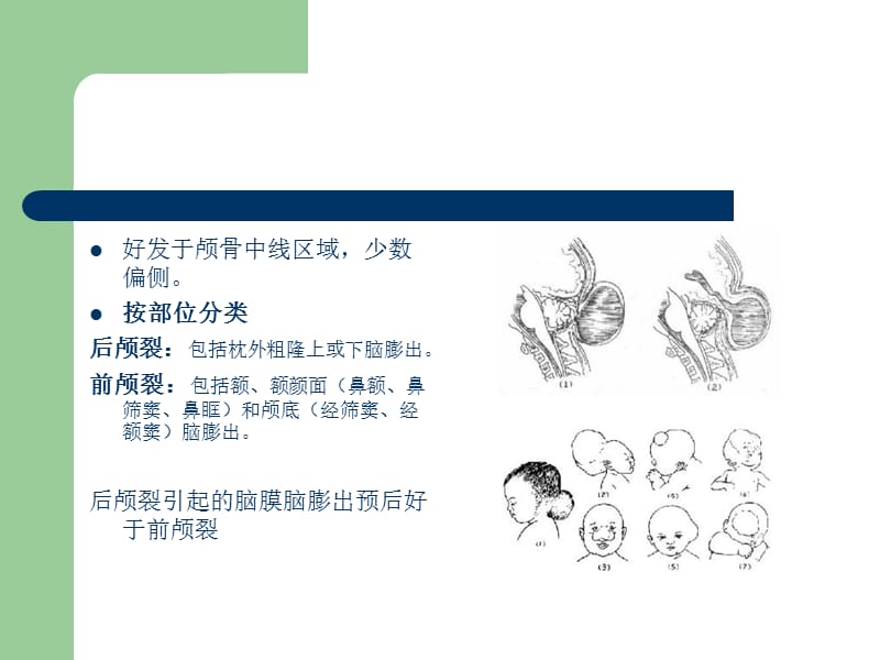 先天性疾病和脑积水--孟庆海ppt课件_第5页