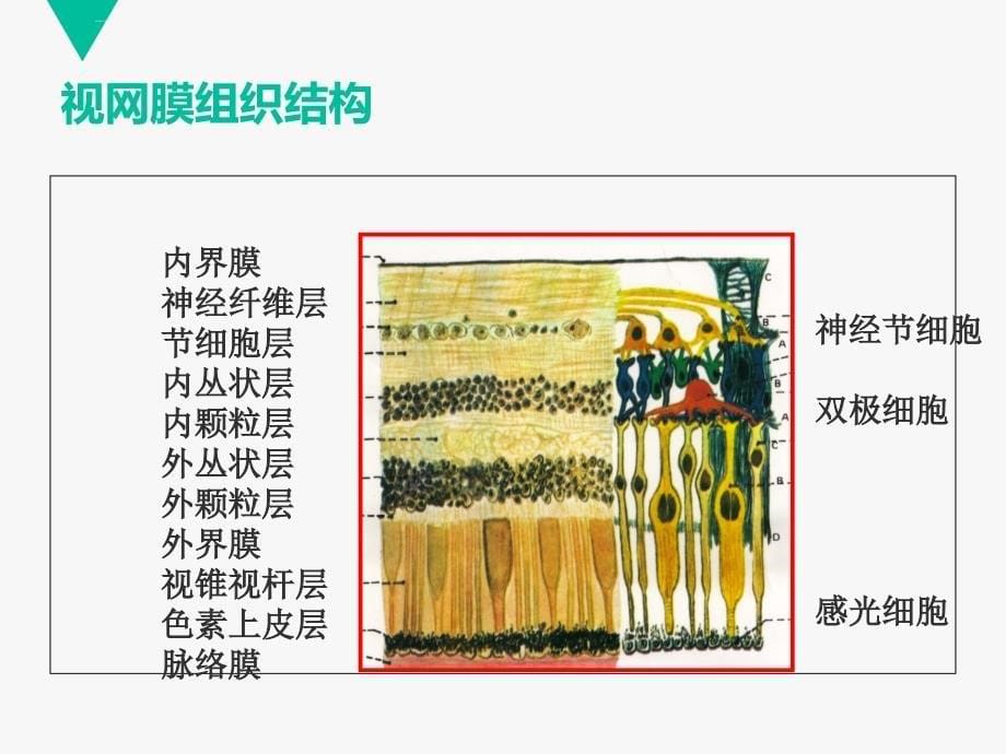 护理查房视网膜脱离 ppt课件_第5页