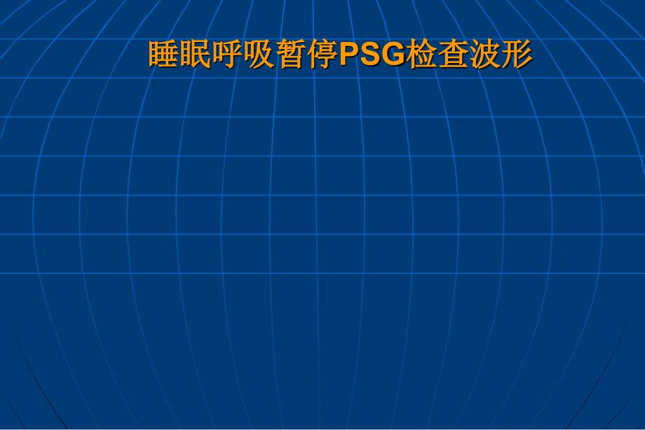 睡眠相关疾患和睡眠医学ppt课件_第4页