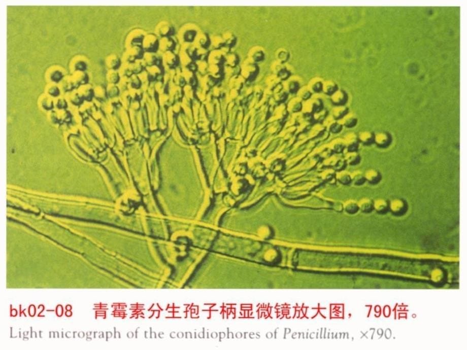 人教版教学课件基因工程及其应用 课件 3知识分享_第5页