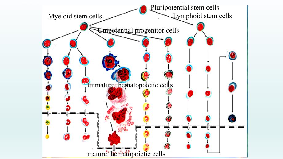 白血病――血液系统疾病――内科学_第3页