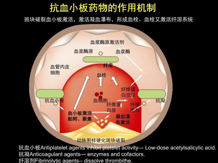 从8指南看糖尿病抗血小板治疗讲解材料_第5页