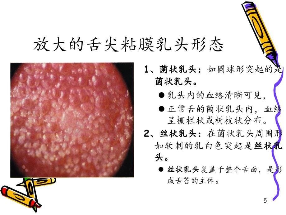 舌质与舌苔变化不一致_第5页