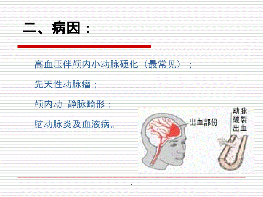 脑出血业务学习ppt课件_第3页