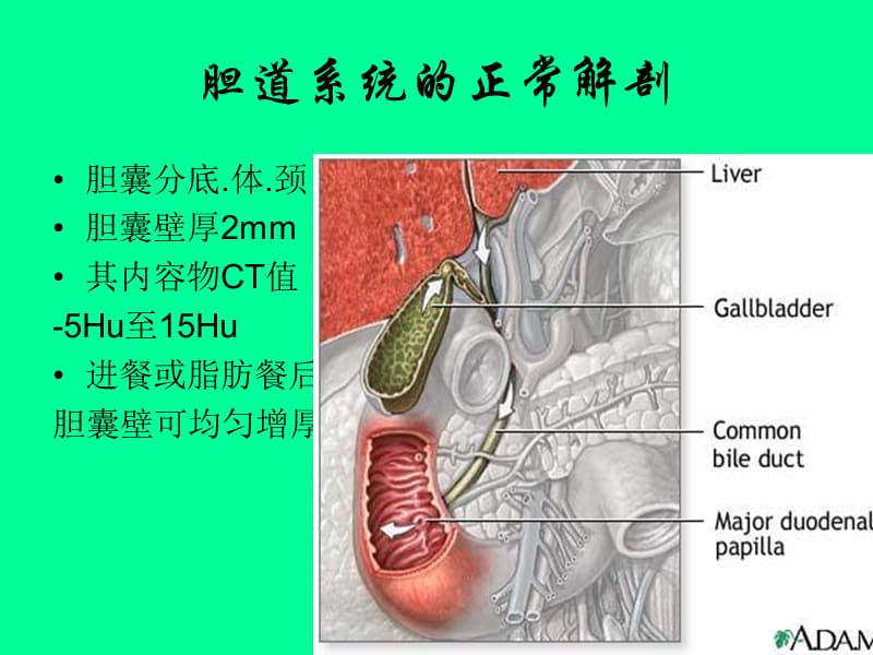 胆道影像诊断PPT_第2页