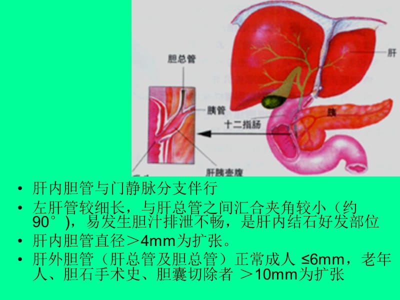 胆道影像诊断PPT_第3页