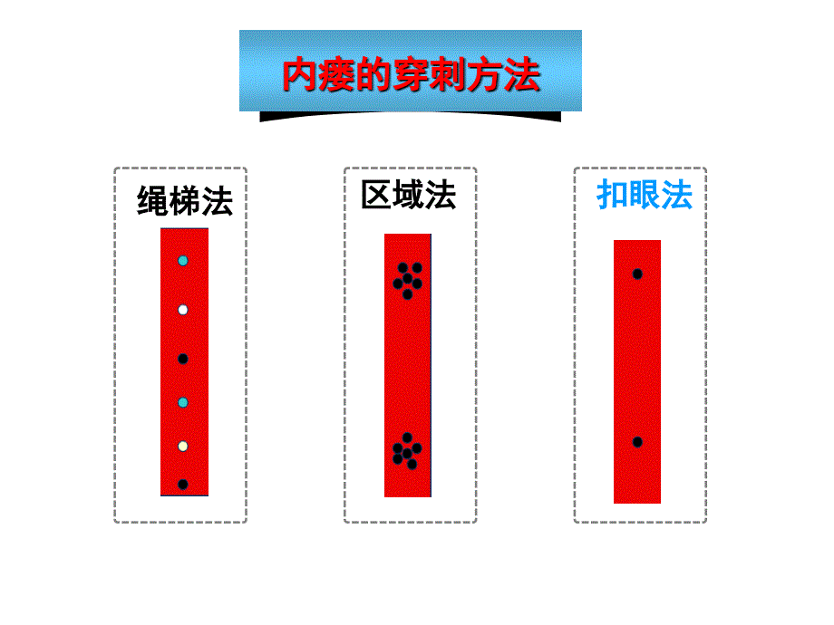 血透授课课件_第2页