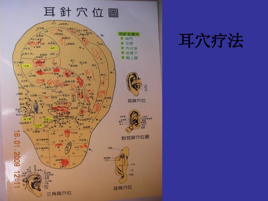 针灸耳穴护士培训课件_第1页