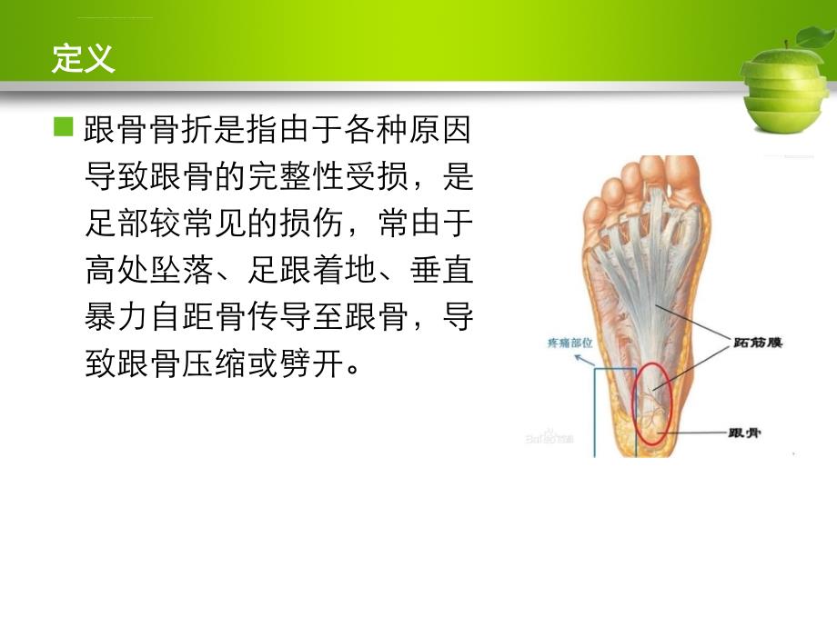 跟骨骨折护理查房课件_第2页