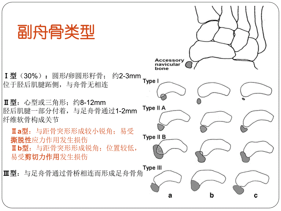 足舟骨和副舟骨的鉴别课件_第4页