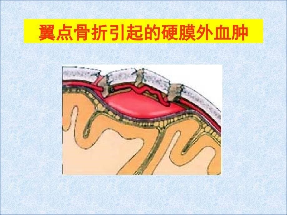 颅的前面和侧面观课件_第5页