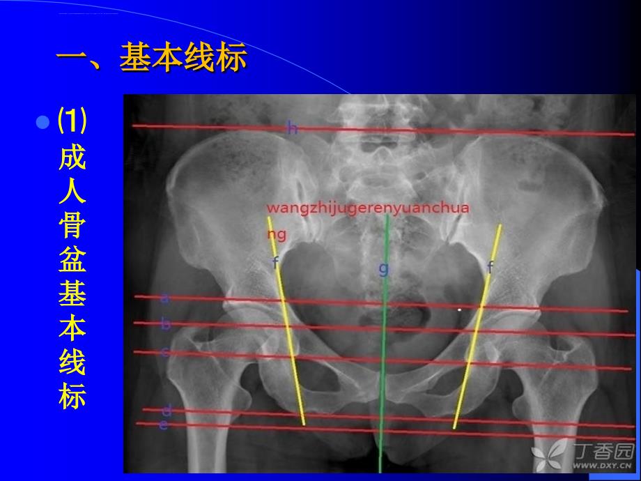 骨盆X线片PPT模版课件_第2页