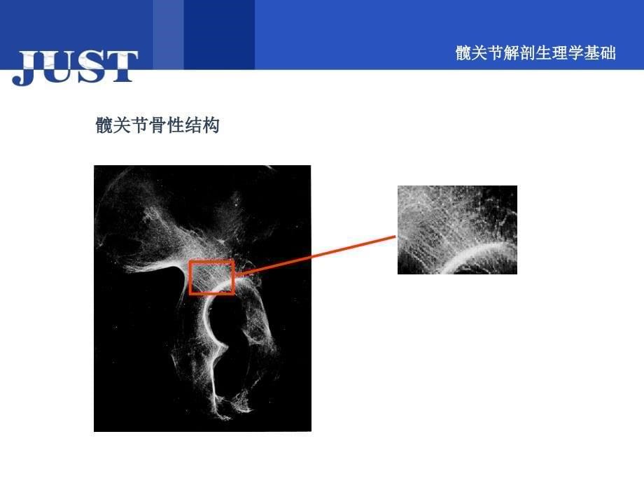 髋关节基础知识课件_第5页