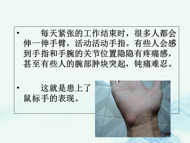 鼠标手是怎么回事讲解学习_第2页