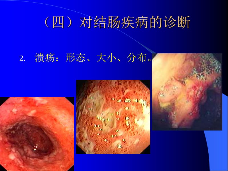 内镜检查4复习课程_第4页