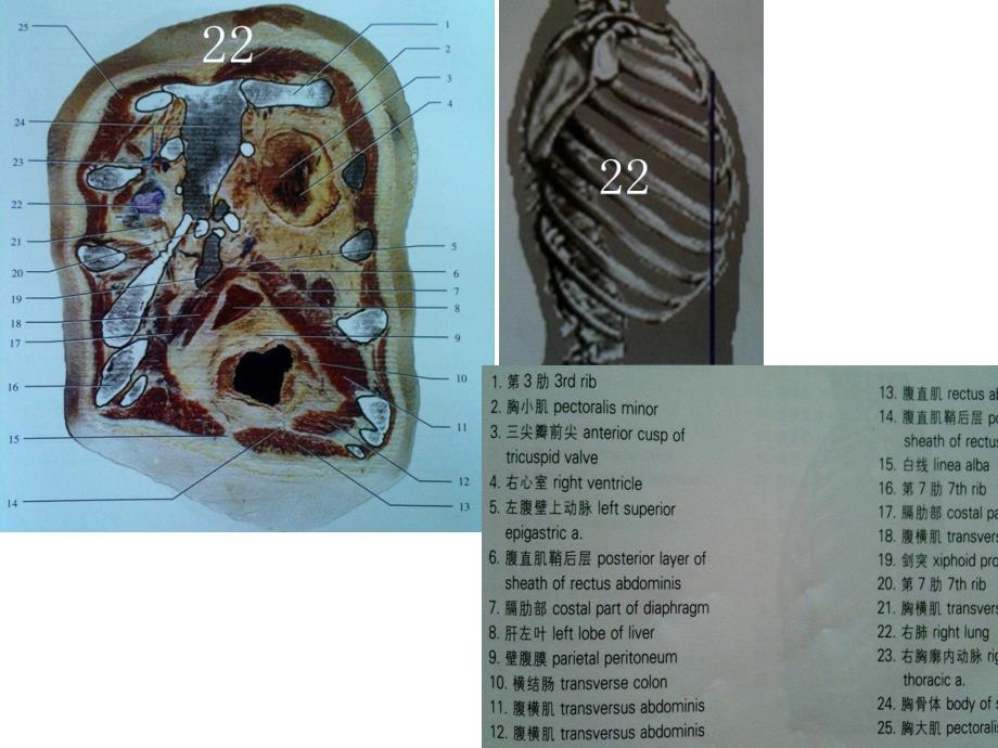 人体断面解剖图谱06-胸部冠状断面教学提纲_第2页