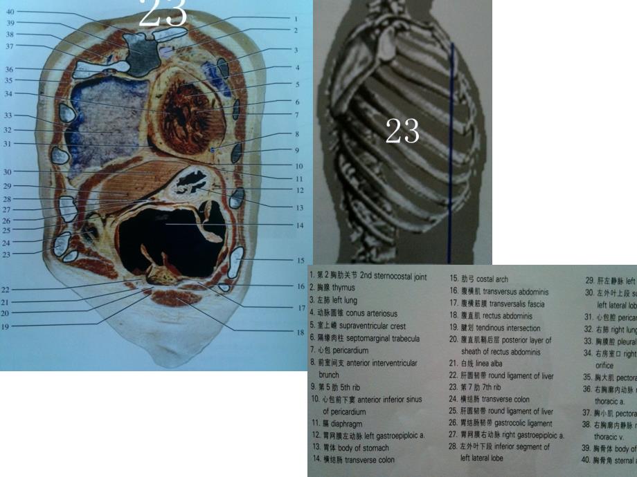 人体断面解剖图谱06-胸部冠状断面教学提纲_第3页