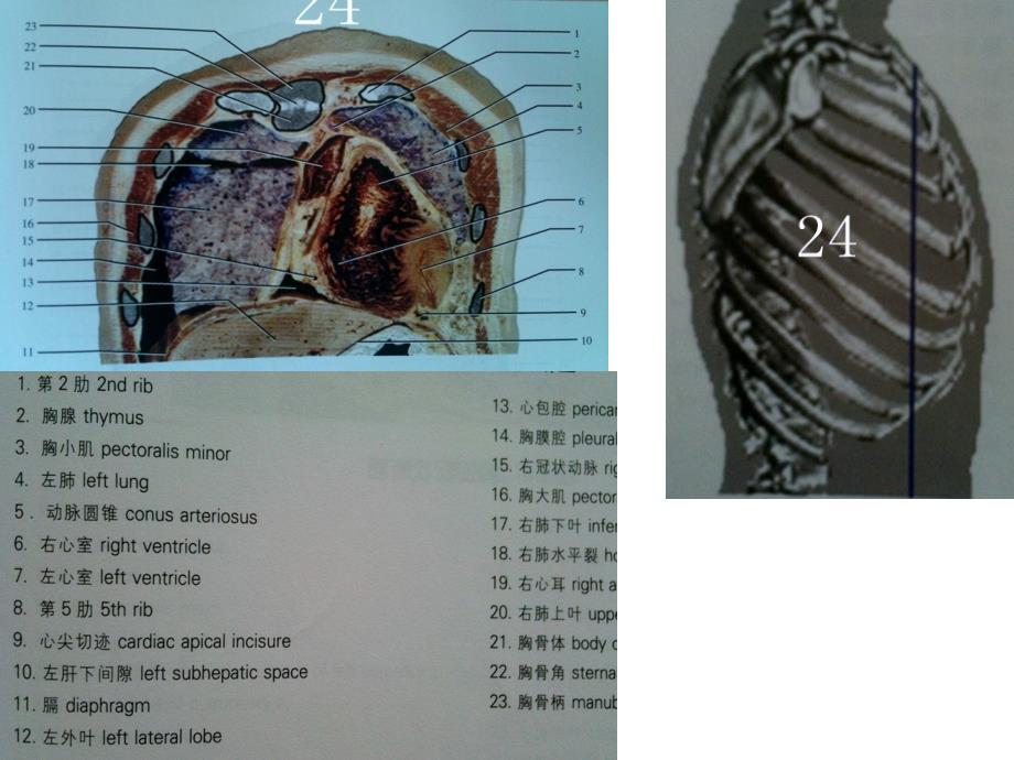 人体断面解剖图谱06-胸部冠状断面教学提纲_第4页
