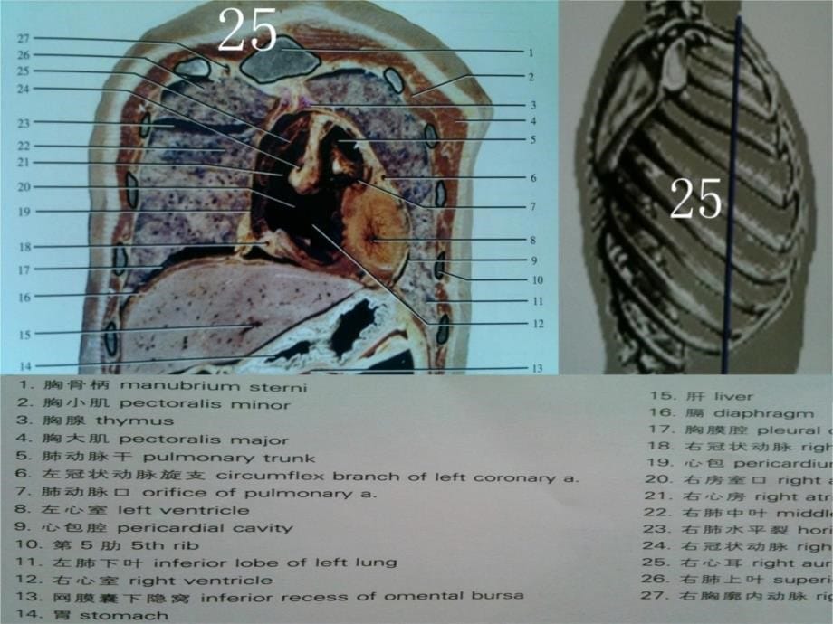 人体断面解剖图谱06-胸部冠状断面教学提纲_第5页