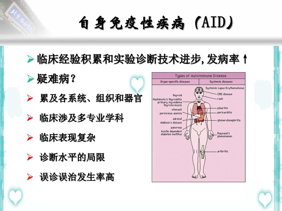 自身免疫性肝病及抗体检测课件_第2页