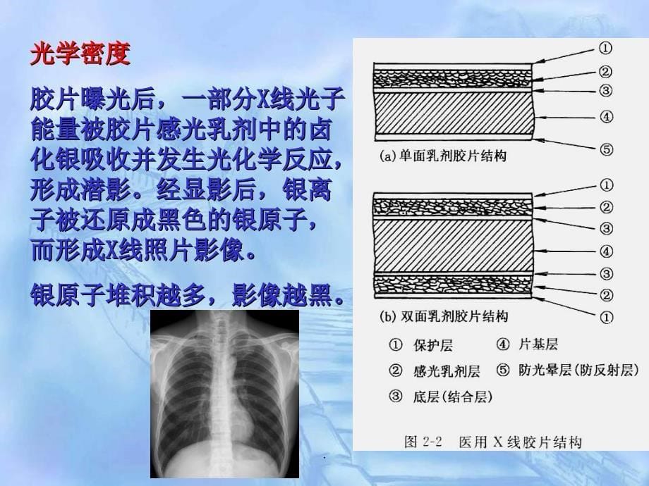 X线成像基本因素_第5页