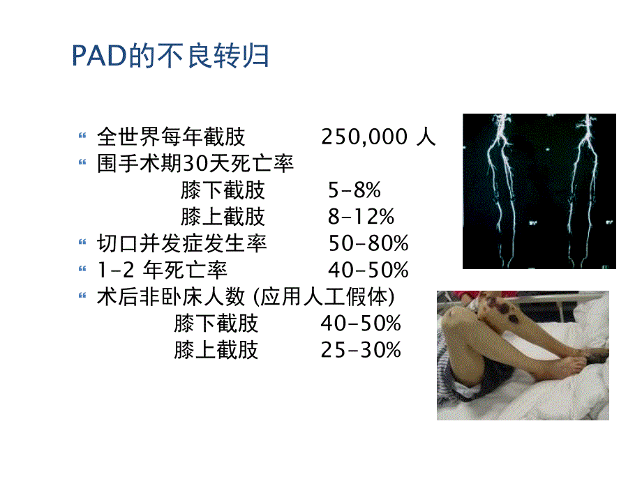 下肢动脉硬化的药物治疗新选择安步乐克教程文件_第4页