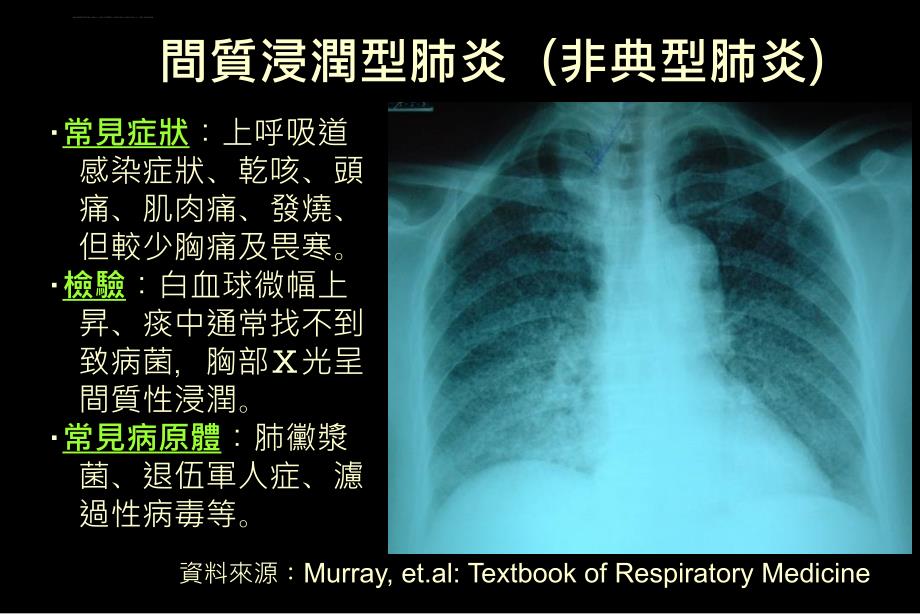 间质浸润型肺炎(非典型肺炎)课件_第1页