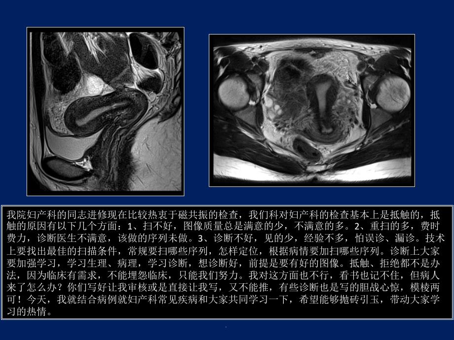 子宫MRI诊断_第2页