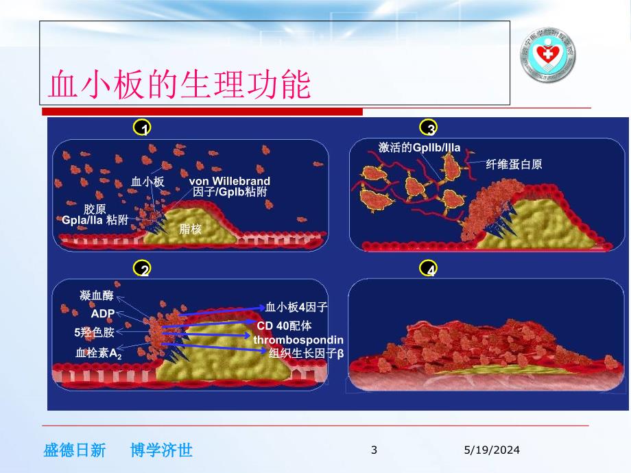 浅谈替罗非班在冠心病中的应用培训资料_第3页