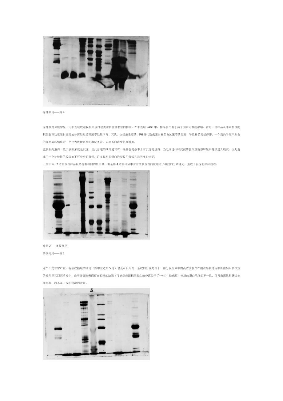 SDS-PAGE失败案列及分析.doc_第2页