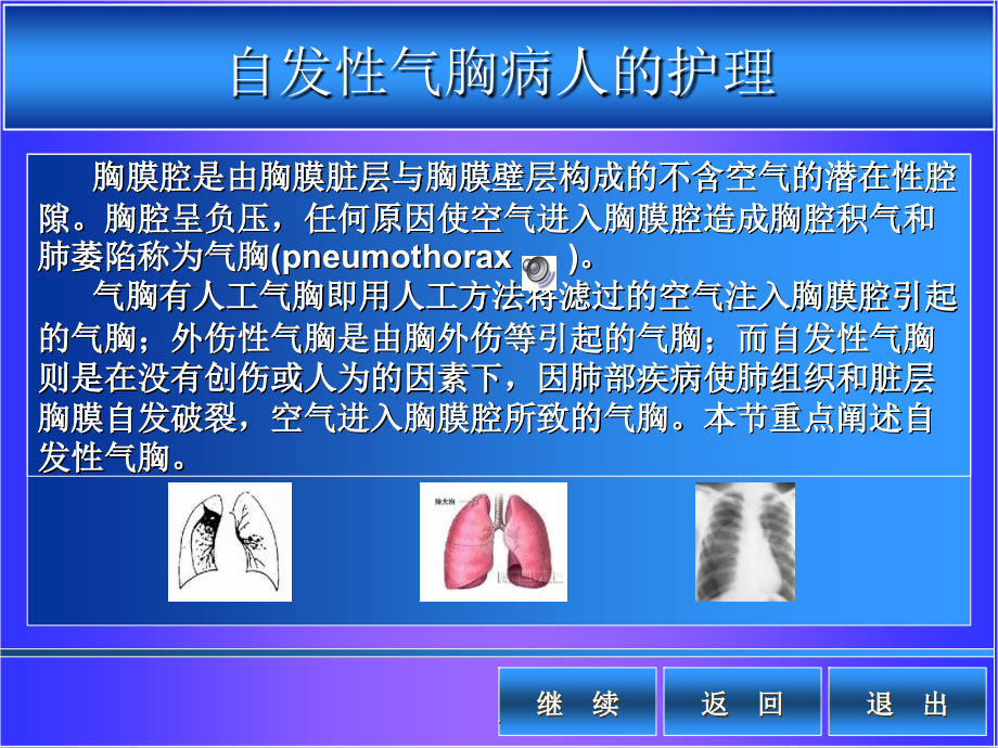 自发性气胸病人的护理-_第1页