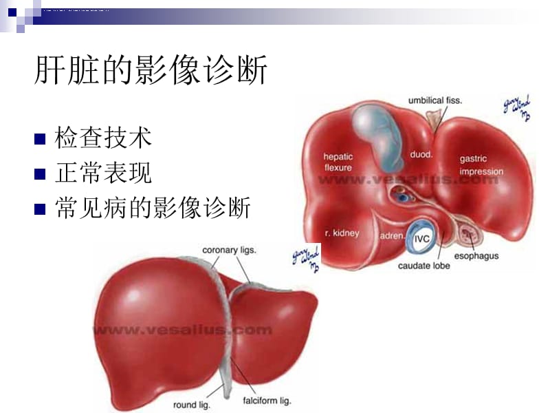 肝胆胰脾影像表现课件_第2页