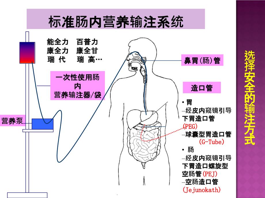 肠内营养并发症的预防及处理最新版本_第2页