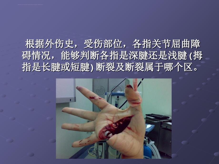 肌腱缝合技术课件_第3页