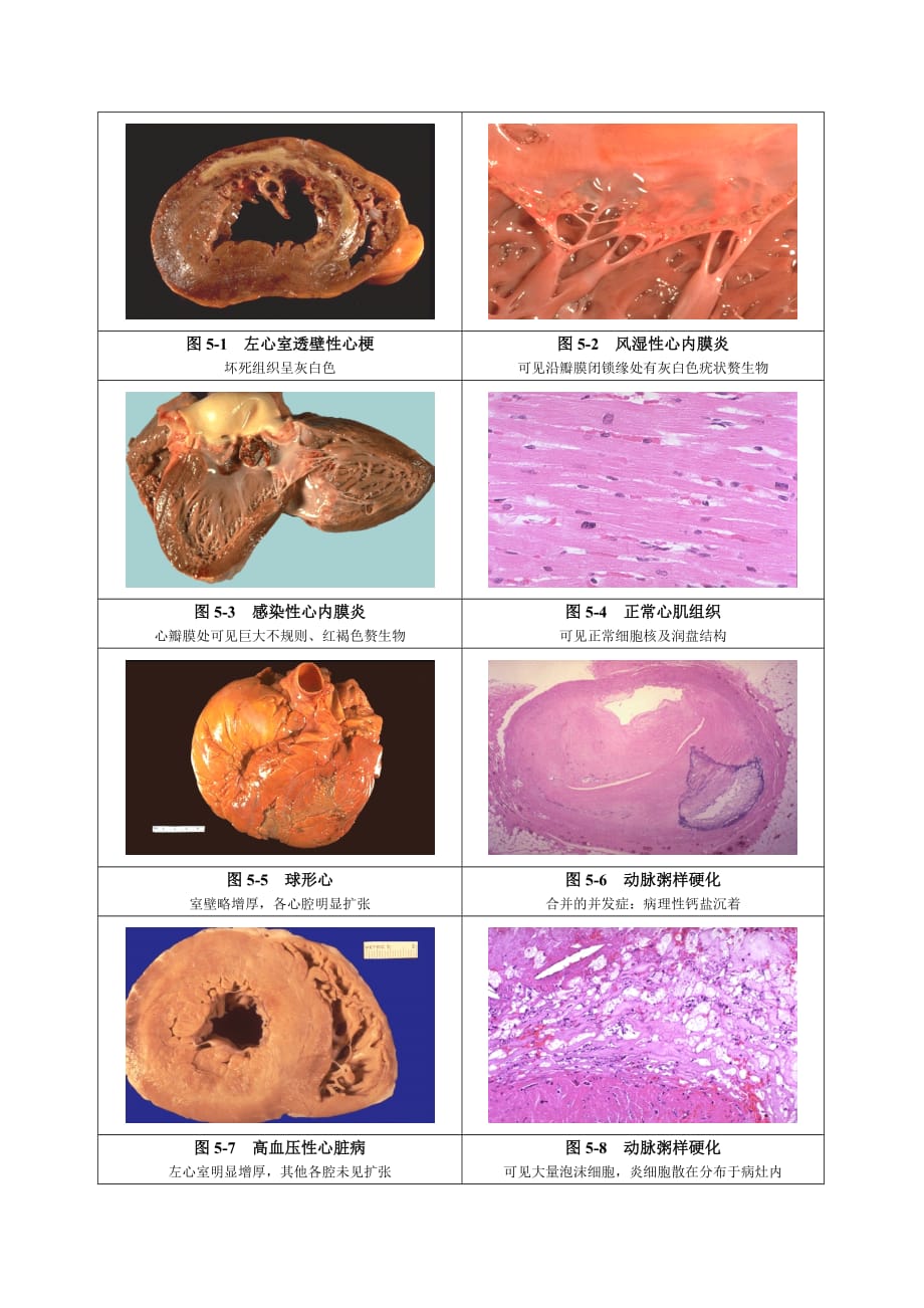 企业组织设计图51左心室透壁性心梗坏死组织呈灰白色图52风湿_第1页