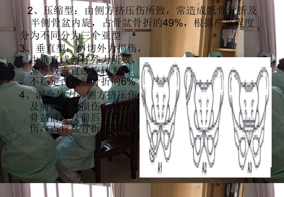 骨盆骨折患者的护理课件_第4页