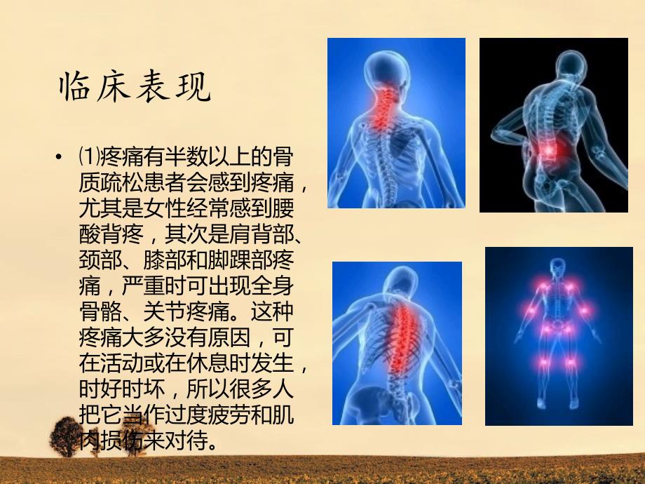 骨质疏松健康教育讲座课件_第3页