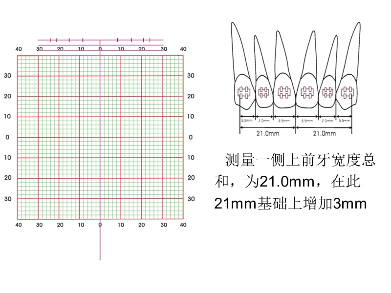 弓丝训练1课件说课讲解_第2页