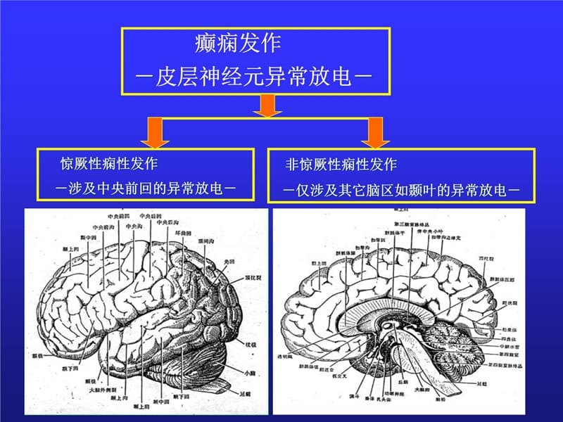 惊厥课件学习资料_第5页