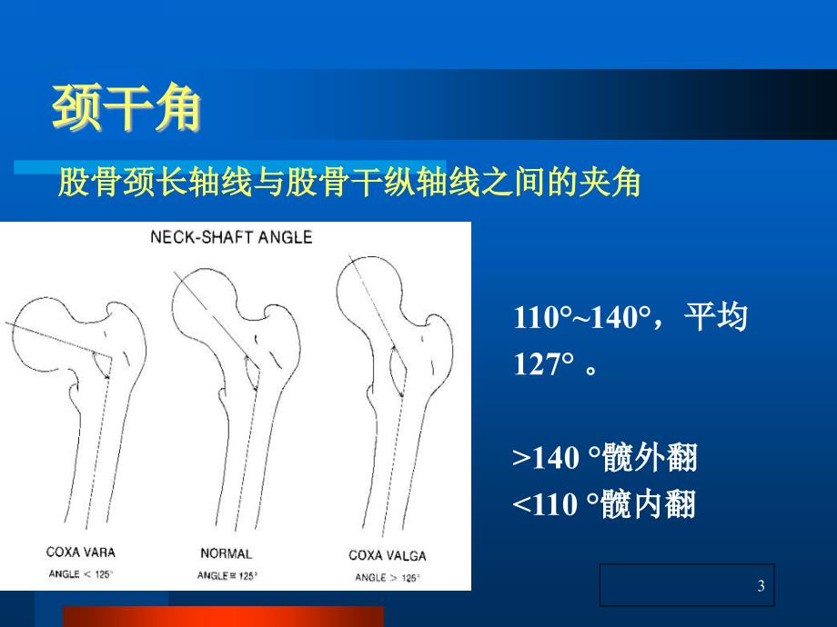 股骨颈骨折ppt__第3页