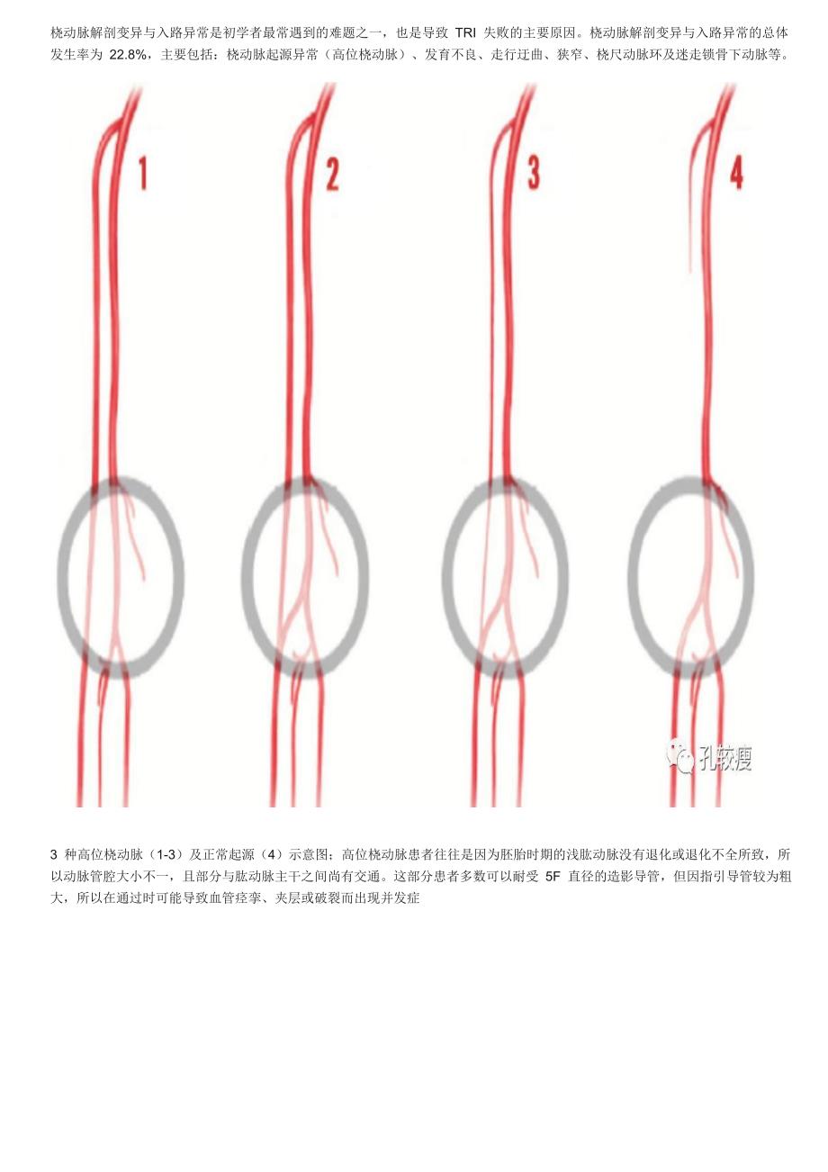 手把手教你桡动脉穿刺技巧(精美图文)_第2页