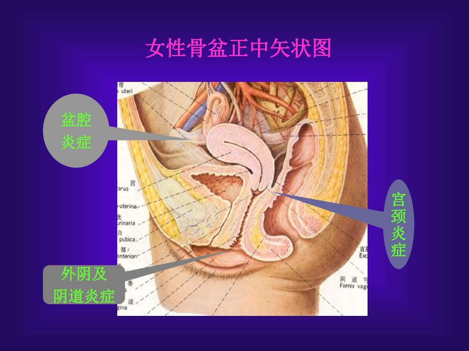 {管理信息化信息化知识}女性生殖系统各种炎症_第2页