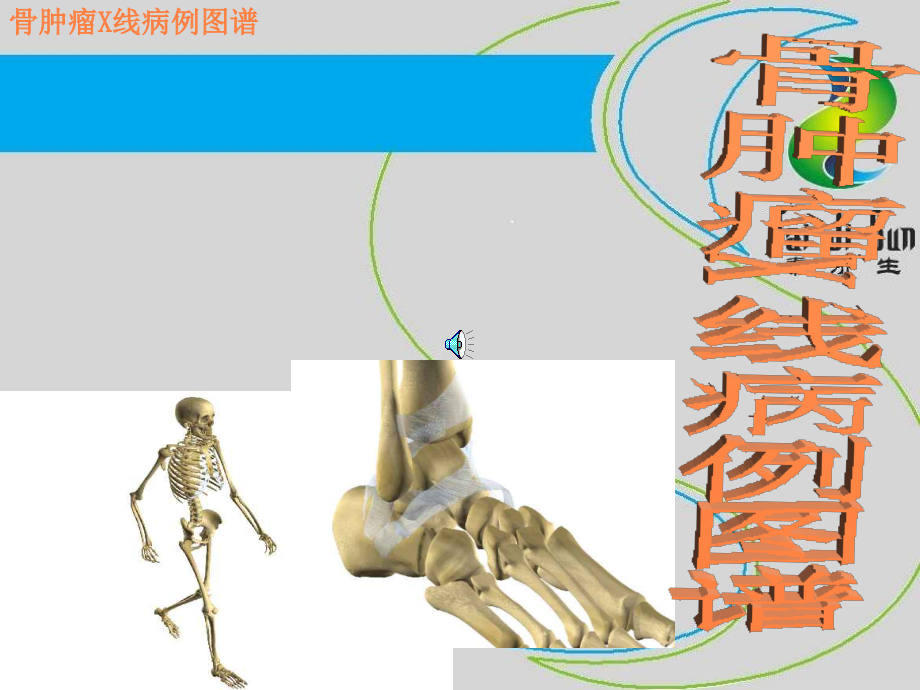 骨肿瘤X线病例图谱1ppt课件_第1页